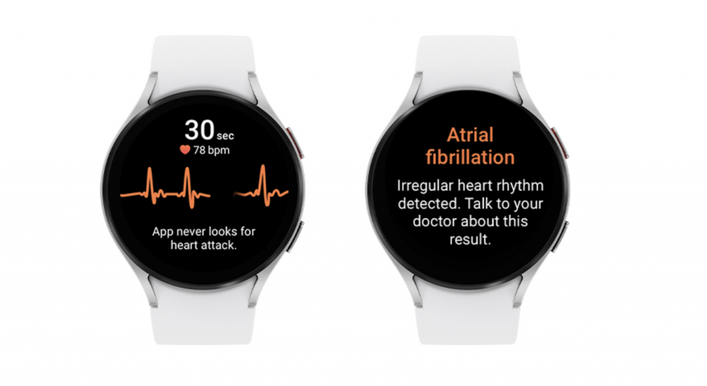 Samsungs Irregular Heart Rhythm Notification feature for the Galaxy Watch receives FDA clearance | SBM Global News