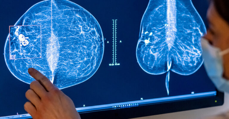 InReversalExpertPanelRecommendsBreastCancerScreeningat40jpg | SBM Global News