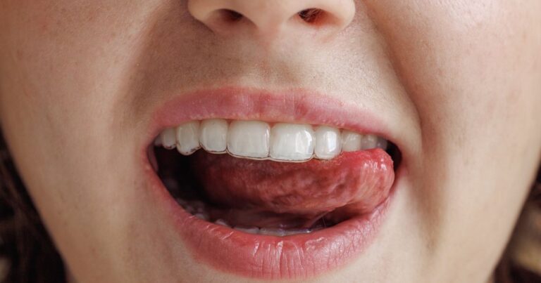 ScallopedTongueWhatItSaysAboutYourHealthjpeg | SBM Global News