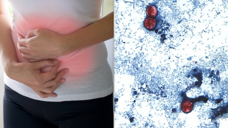 KeySignsYourDiarrheaCouldBeCyclosporiasisjpeg | SBM Global News