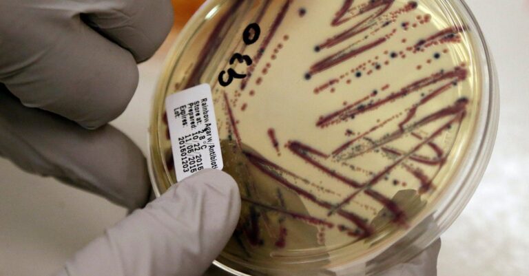 AlfalfaSproutOutbreakLinkedToFoodPoisoningIn15Statesjpeg | SBM Global News